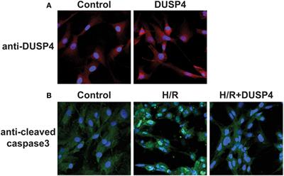 Dual-Specificity Phosphatase 4 Overexpression in Cells Prevents Hypoxia/Reoxygenation-Induced Apoptosis via the Upregulation of eNOS